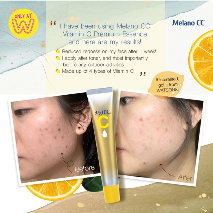 Melano CC Vitamin C Premium Essence - 20ml - Lymo Maroc